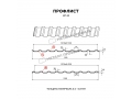 Профлист Металл Профиль МП-20x1100-R (ПЭ-01-3003-0,45)